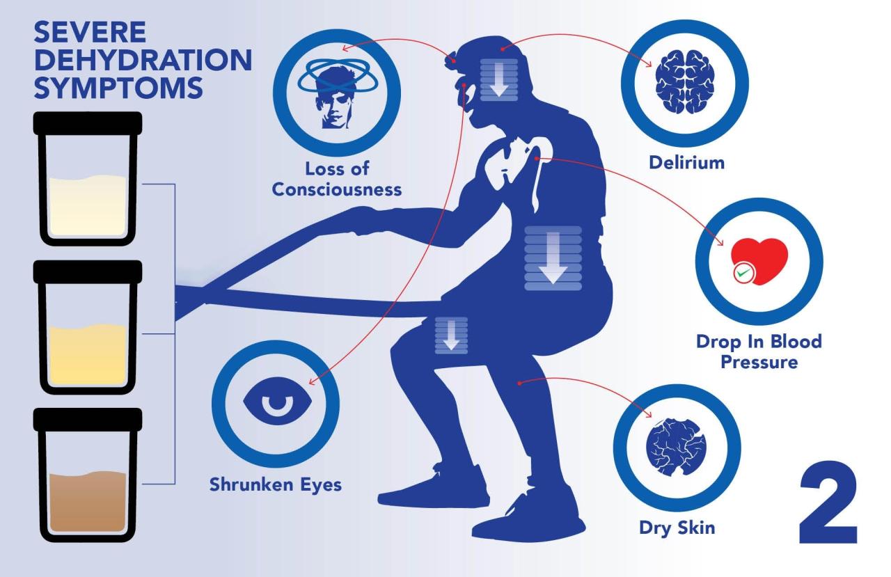 Dehydration Symptoms Chart What Are The Symptoms Of Dehydration